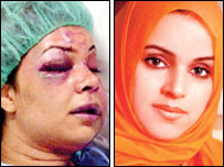 Rania al-Baz: Before and After Rania al-Baz: Before and After